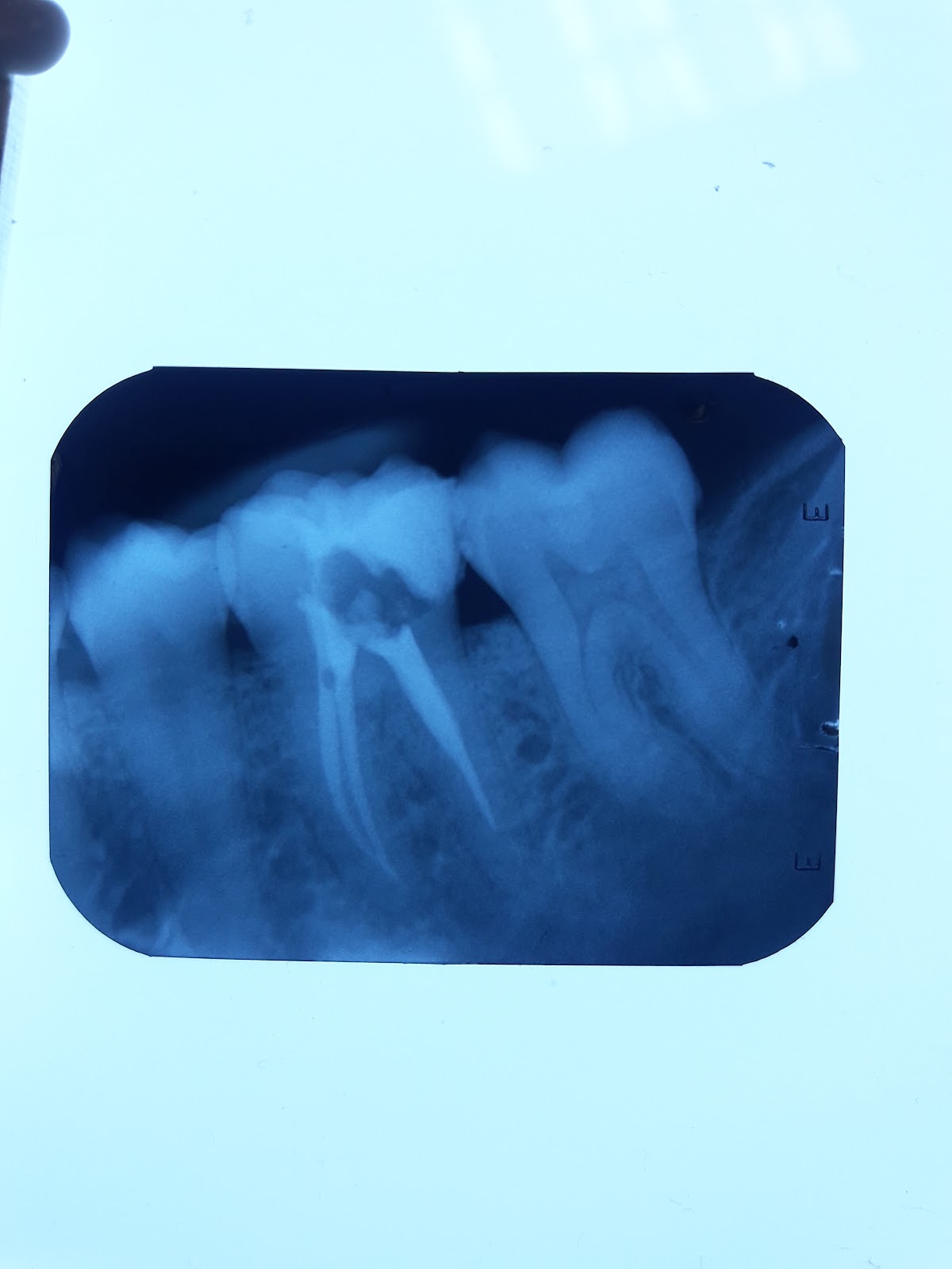 ENDODONCIA CONDESA — foto 3