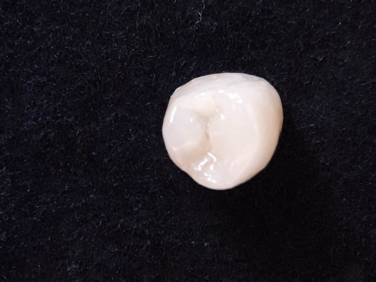 ENDODONCIA CONDESA — foto 4
