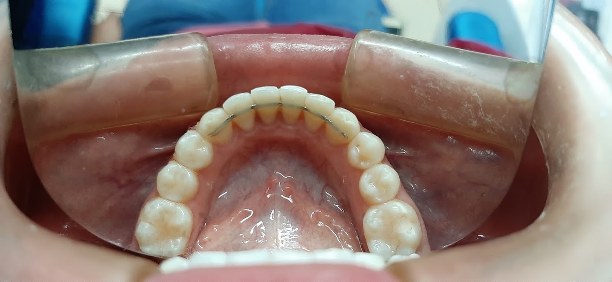 Consultorio y Laboratorio Dental Valladolid — foto 2