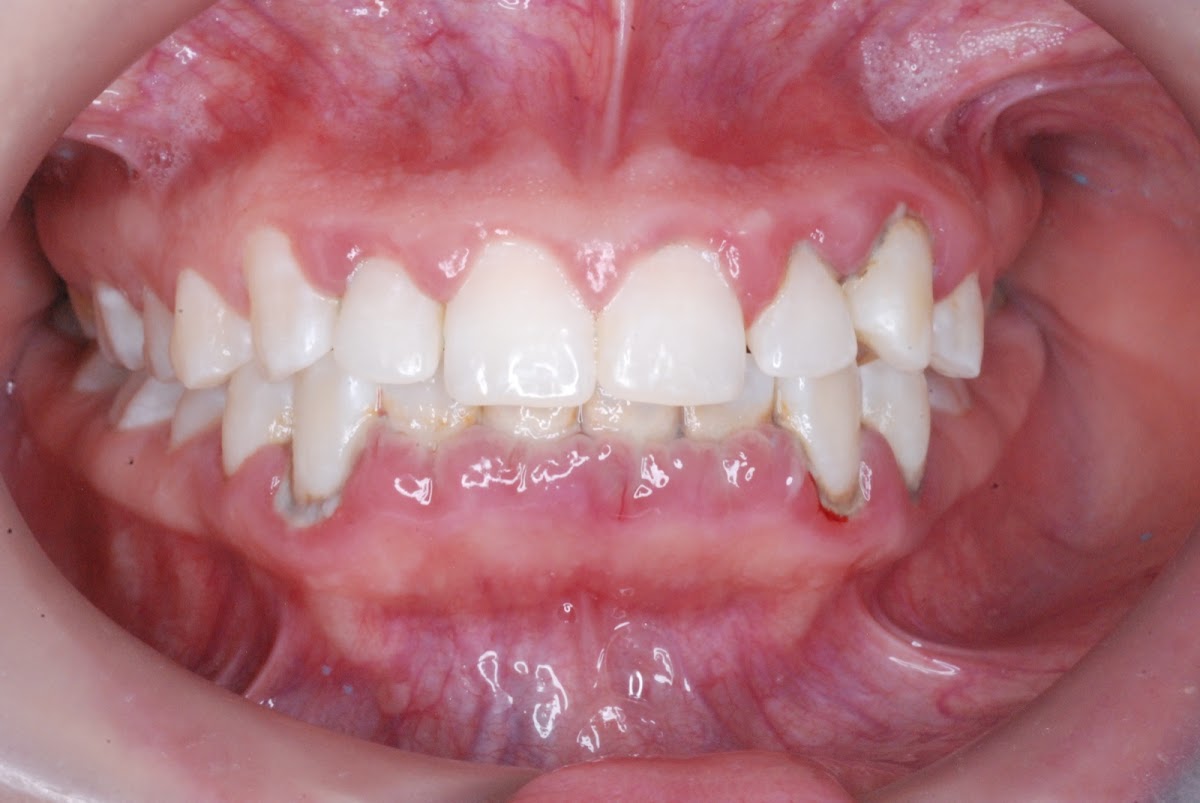 Mc Periodontal | Periodoncista Monterrey - Dentista | Dra. Maria Cristina Garcia — foto 3