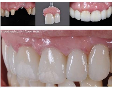 Dental St. Engracia, San Pedro Garza García