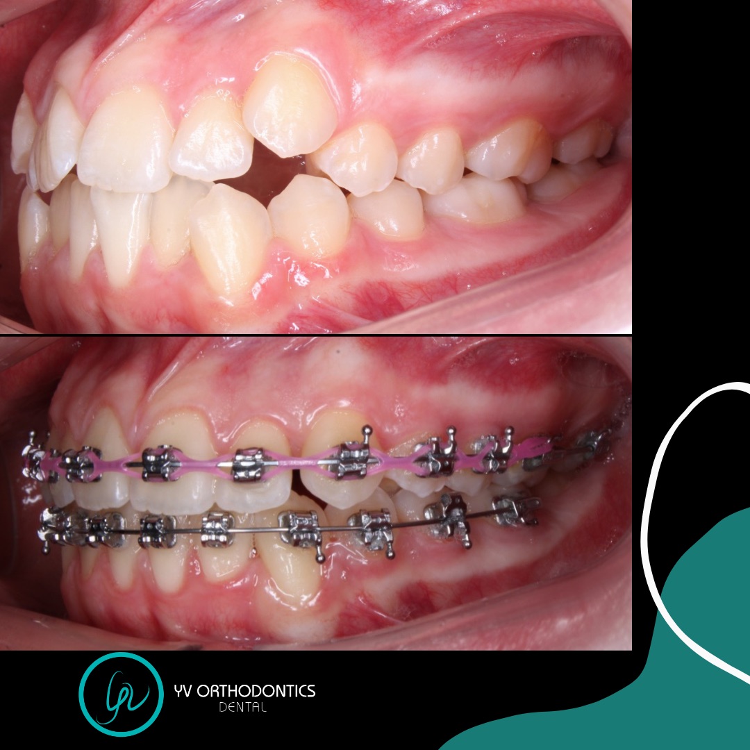 Dental YV Orthodontics