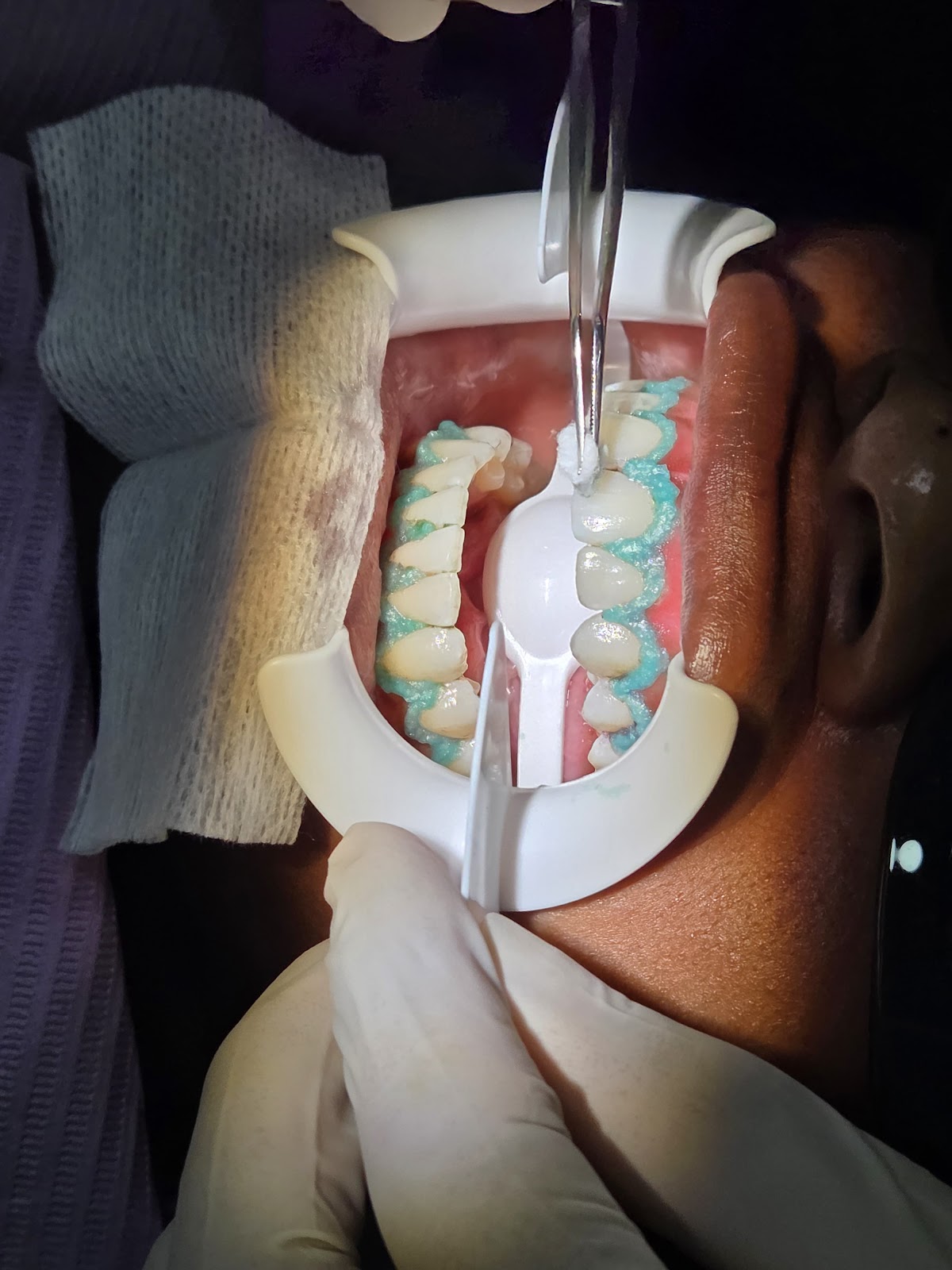 Dental YV Orthodontics — foto 2