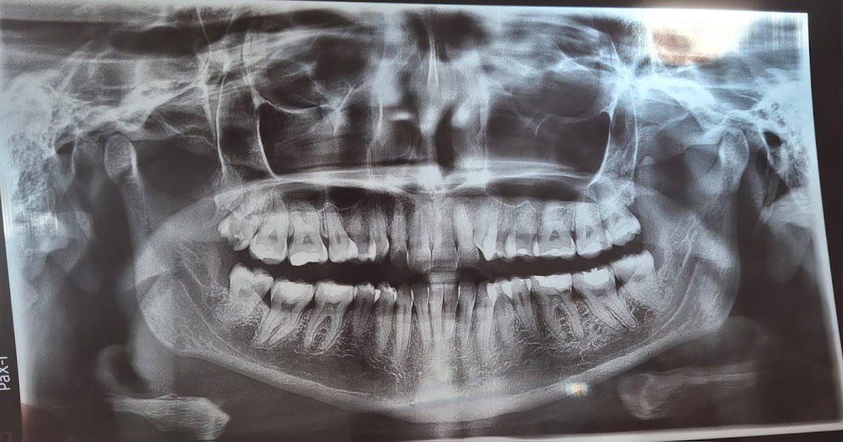 Clinica Dental LIDent, Otras zonas