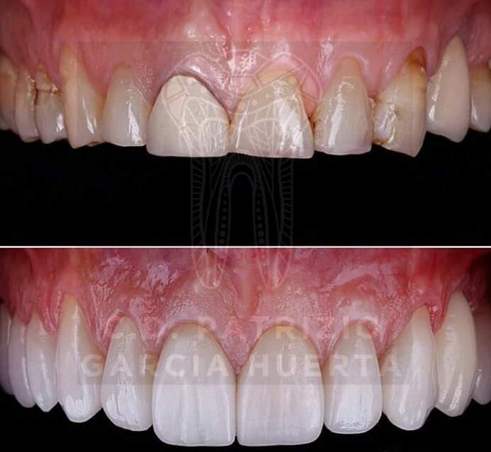 Odontología Restauradora Patrizio García — foto 3