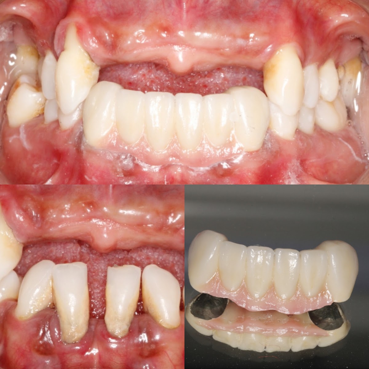 MOLAR Consultorio Dental 24hrs AGS, Otras zonas