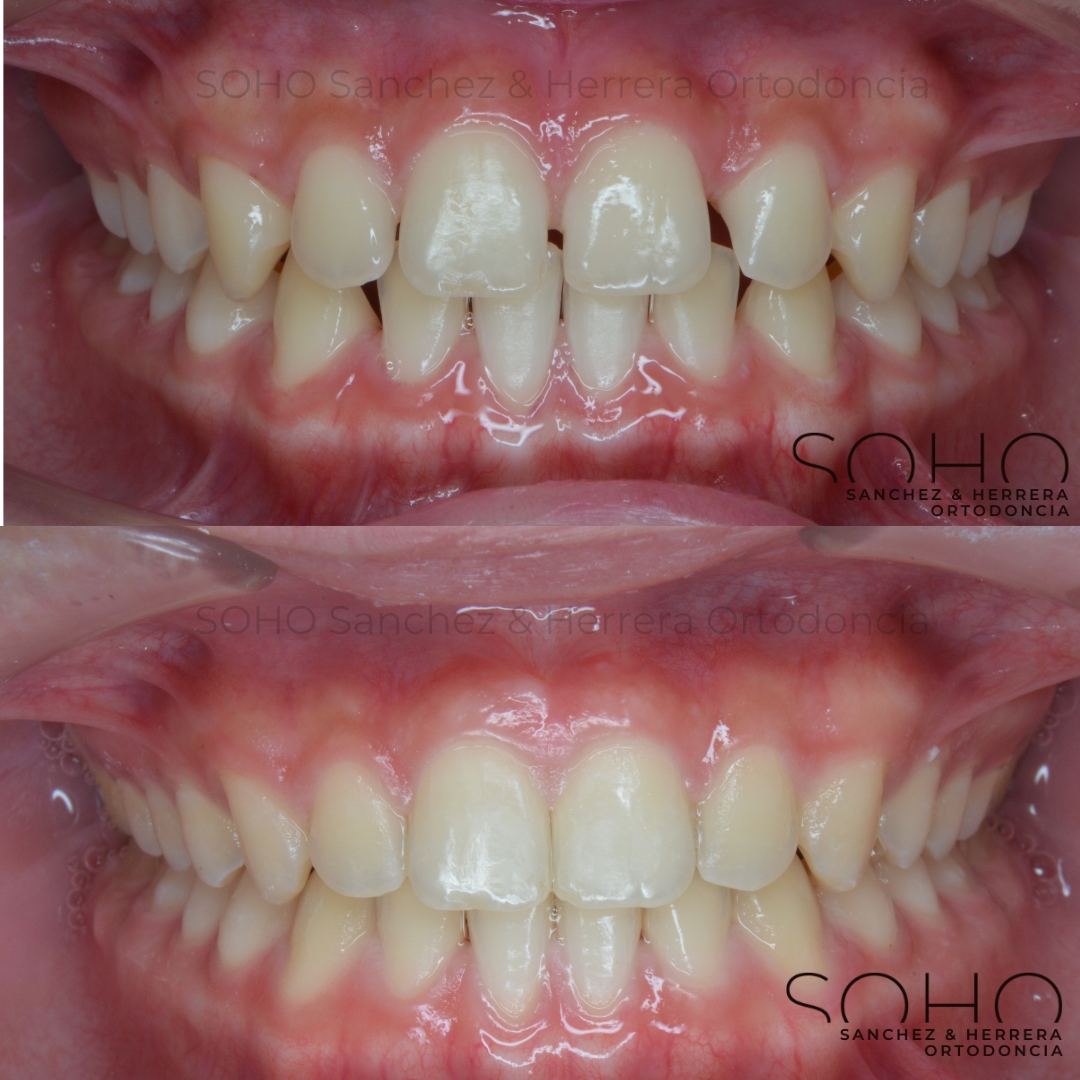 Sánchez & Herrera Ortodoncia by SOHO Elite Doctors. — foto 4
