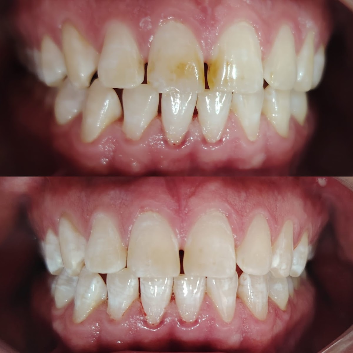 Dra. Arely Quezada Médico Estomatólogo (consultorio Dental) — foto 4