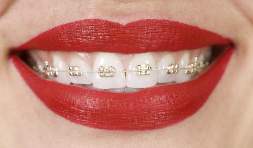 Orthoendo Dentistry