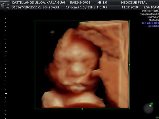 Medicsur Fetal