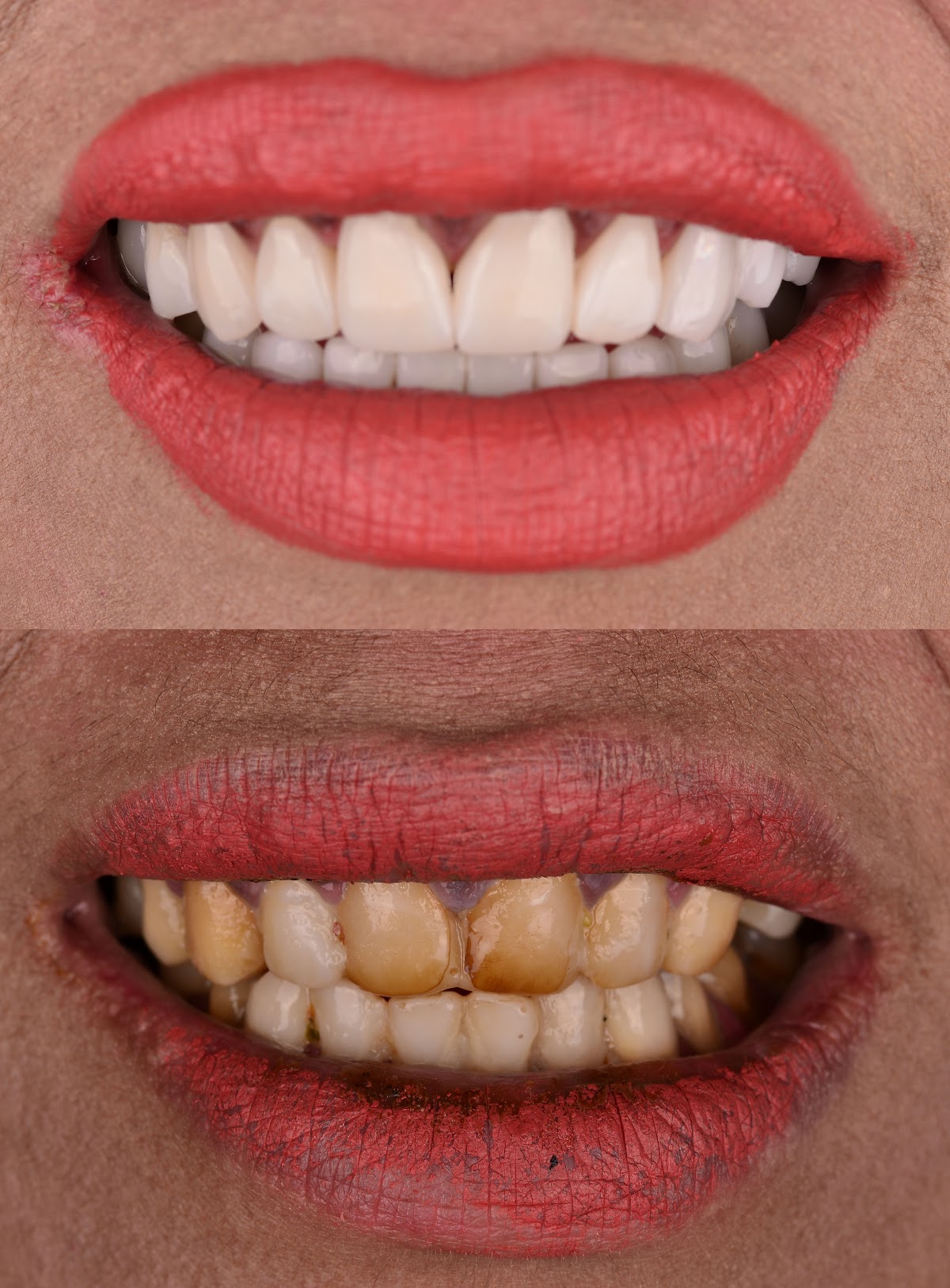 UNIQUE DENTAL CLINIC CANCUN MX