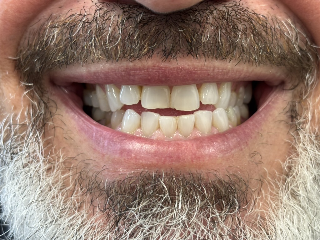 UNIQUE DENTAL CLINIC CANCUN MX — foto 3