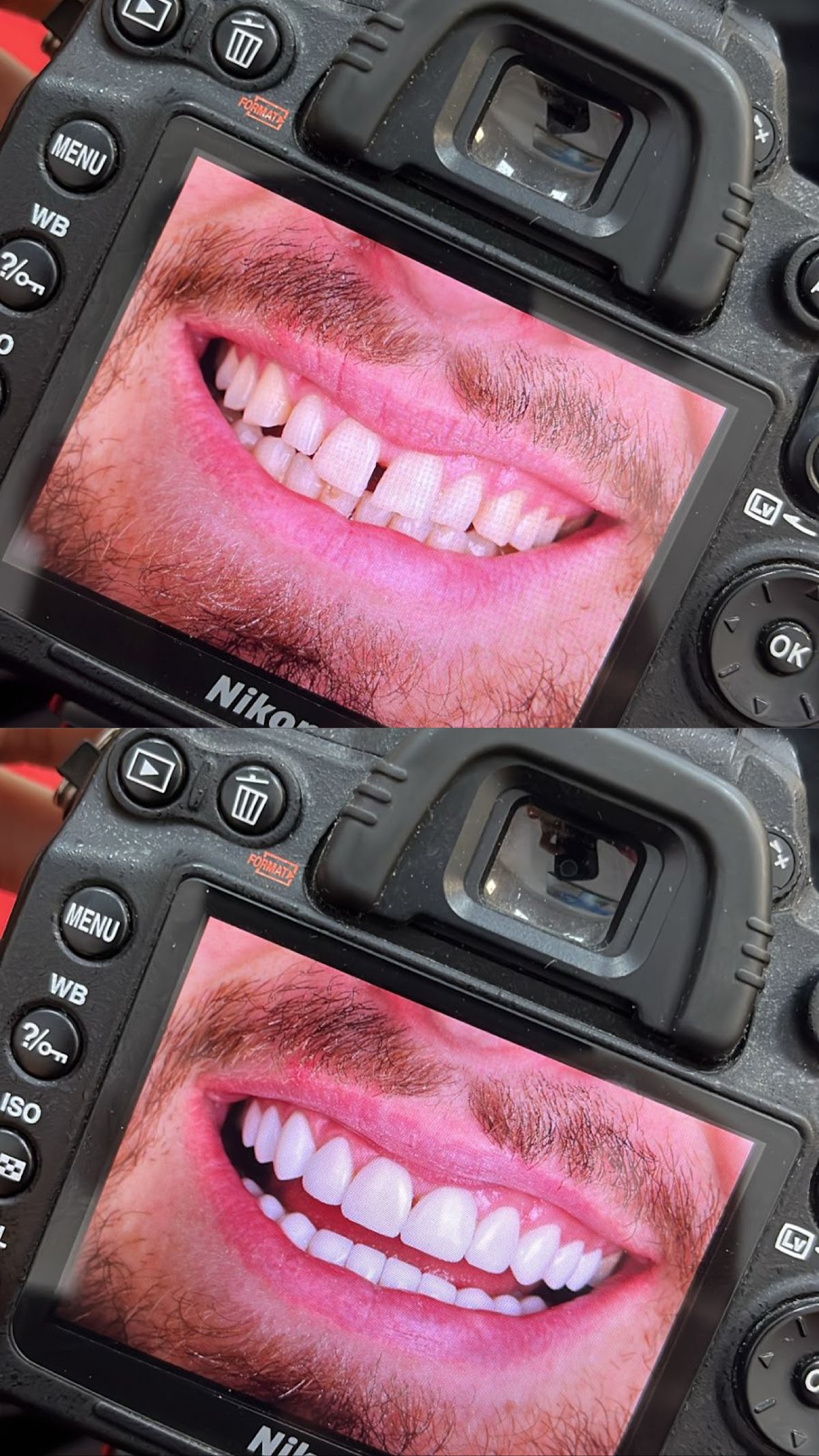 UNIQUE DENTAL CLINIC CANCUN MX — foto 4
