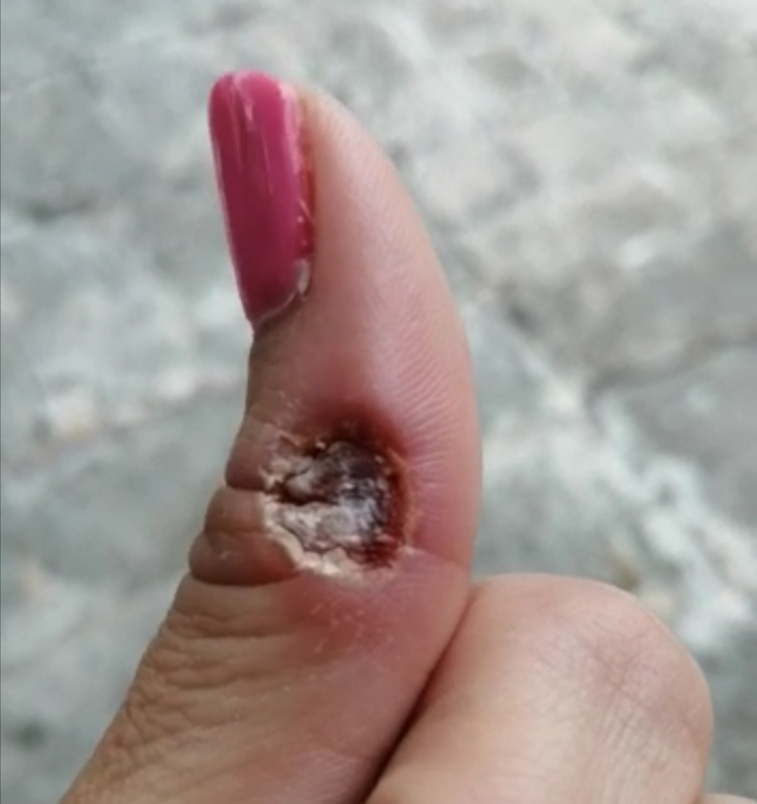 Dra. Diana Elena Conde Medina, Dermatólogo — foto 3