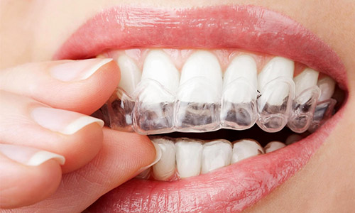 Lotus Dental | Dentista en León GTO — foto 3