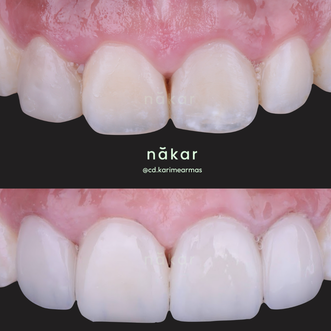 Dentista Karime Armas - Nákar Odontología Polanco CDMX