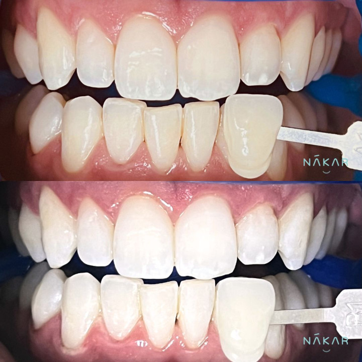 Dentista Karime Armas - Nákar Odontología Polanco CDMX — foto 3