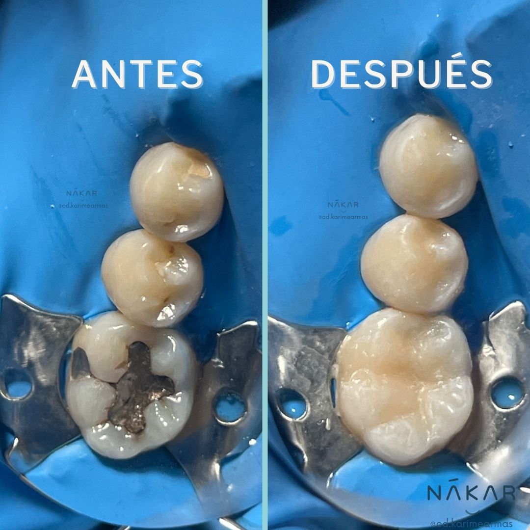 Dentista Karime Armas - Nákar Odontología Polanco CDMX — foto 4