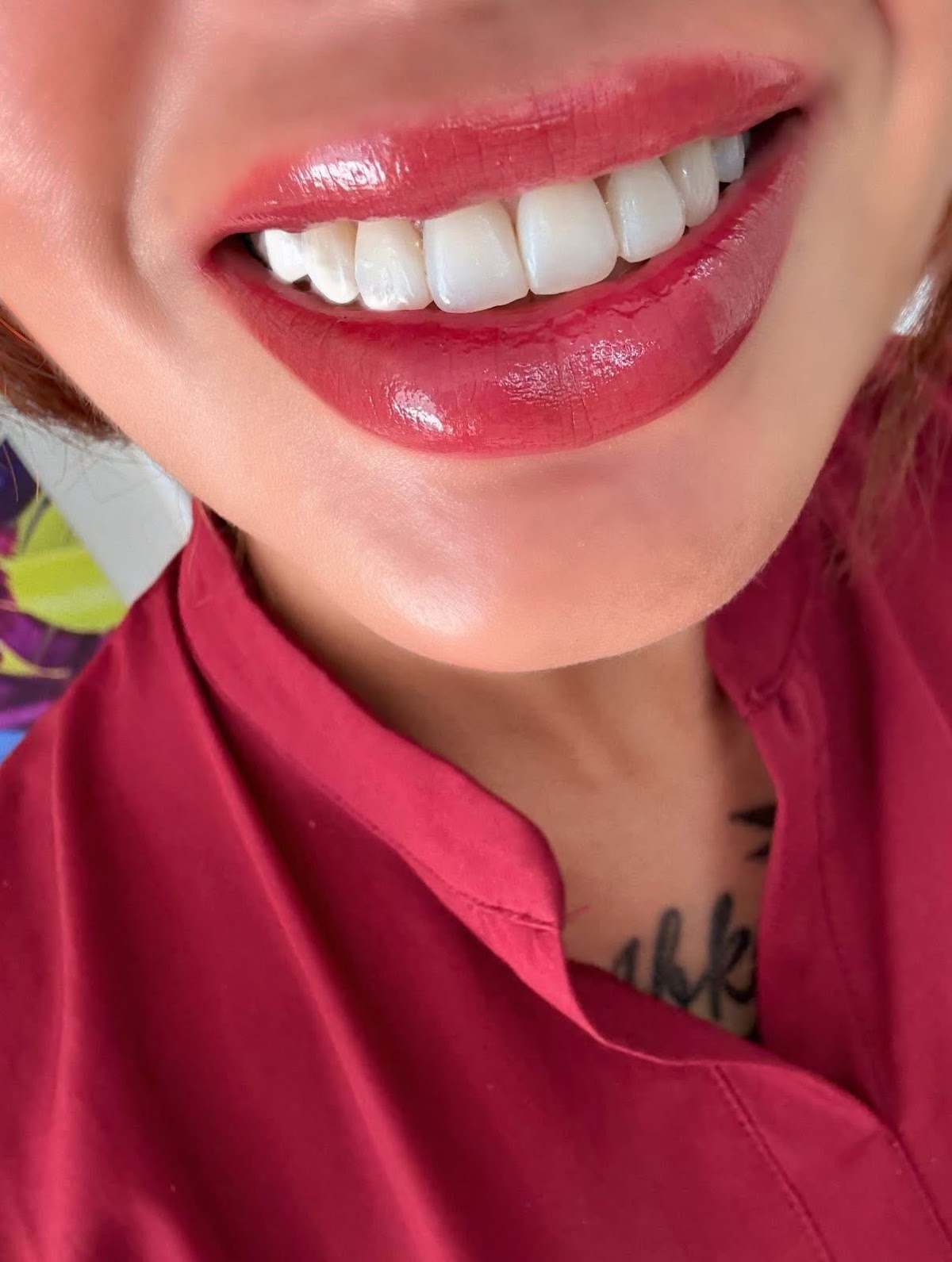 Brackets en Morelia — foto 4