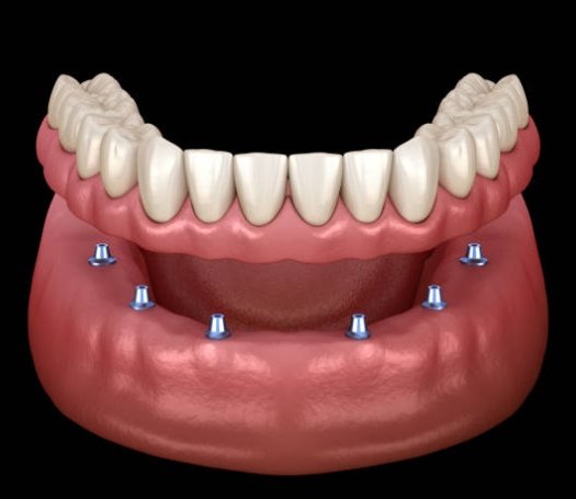 Clínica Dental Pachur — foto 3