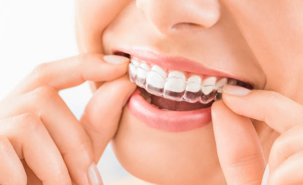 Superdental — foto 2