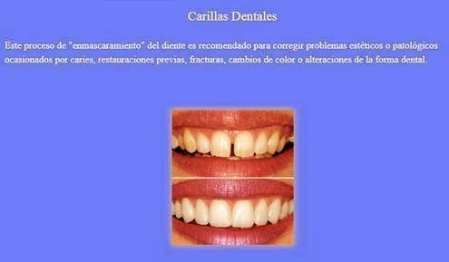 Dentistas en Puebla Clinica Dental Spota — foto 3