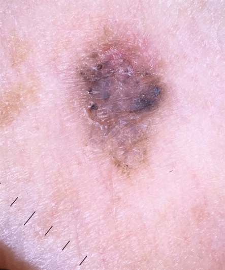 Dra. Virginia Susana Luna Magaña, Dermatólogo