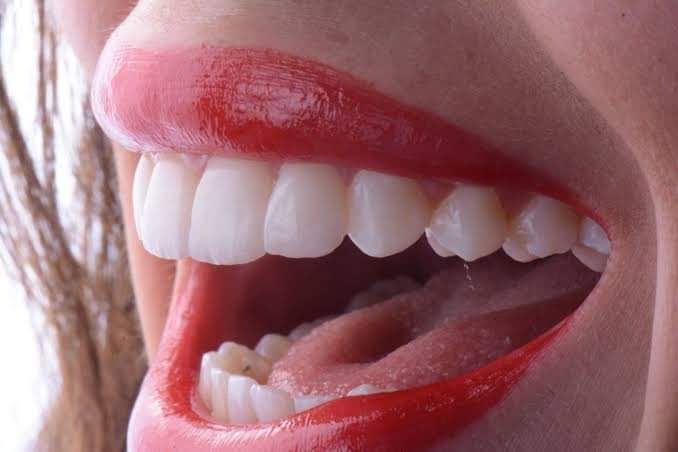 M' Dental Integral