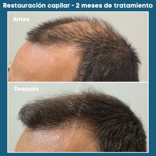 Dr. Irving Llibran Reyna Rodríguez, Dermatólogo — foto 3