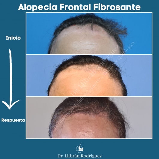 Dr. Irving Llibran Reyna Rodríguez, Dermatólogo — foto 4