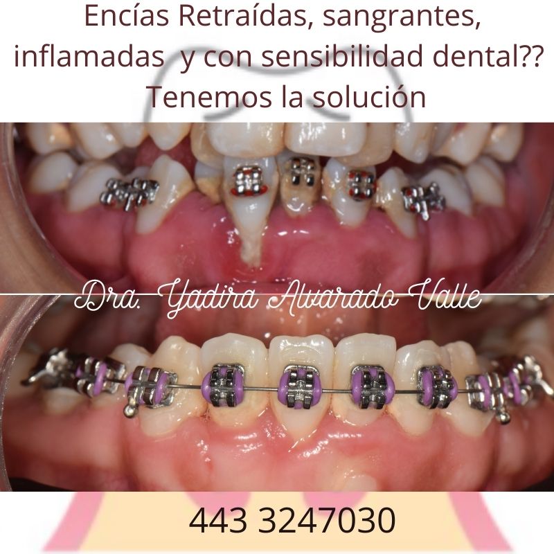 InnDental Morelia, Centro Histórico