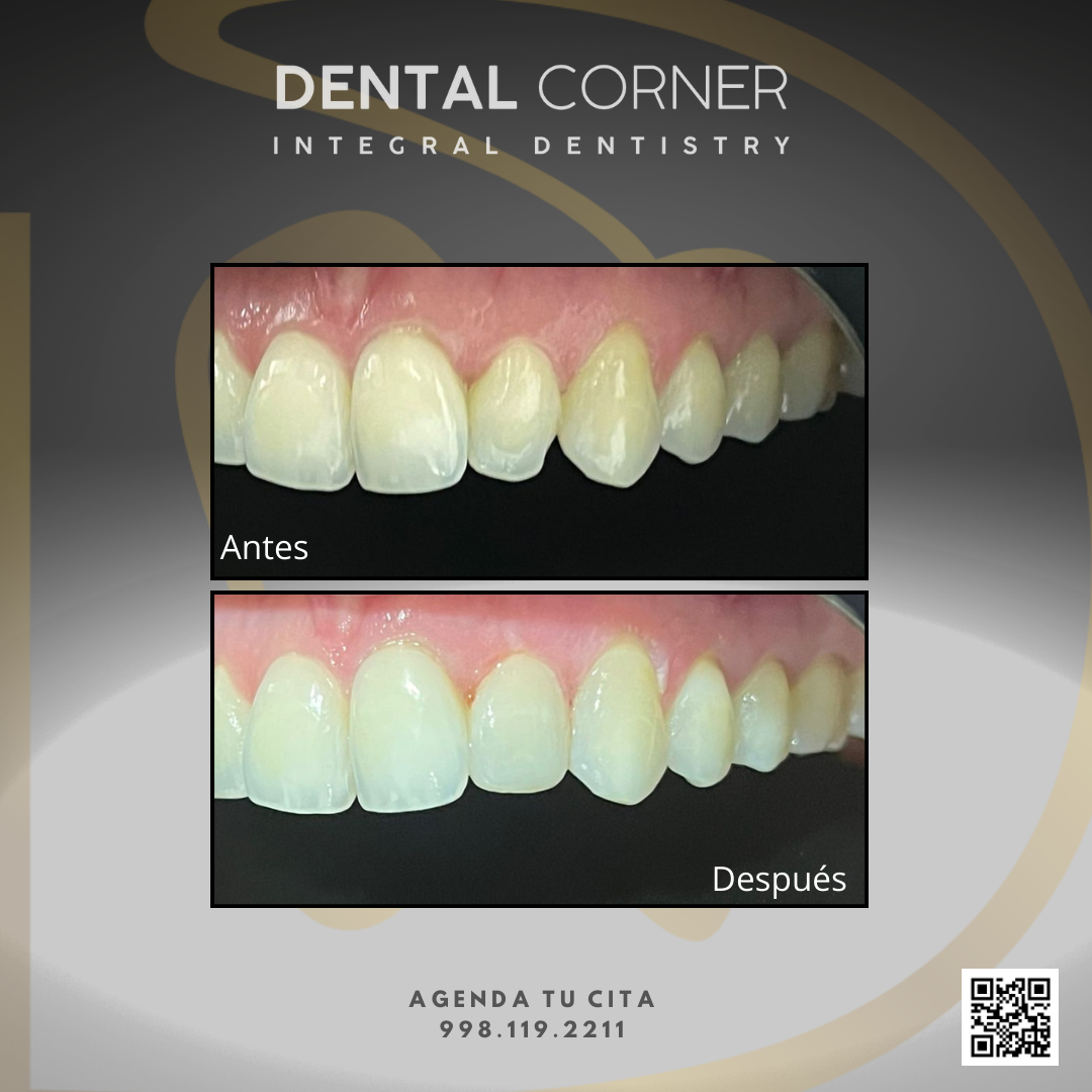 Clínica Dental Corner — foto 4