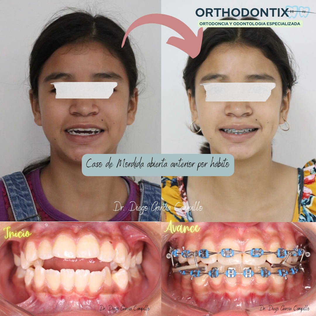 Orthodontix Juriquilla — foto 3