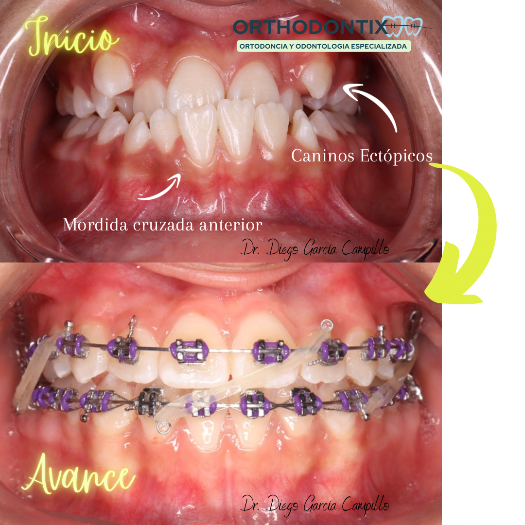 Orthodontix Juriquilla — foto 4