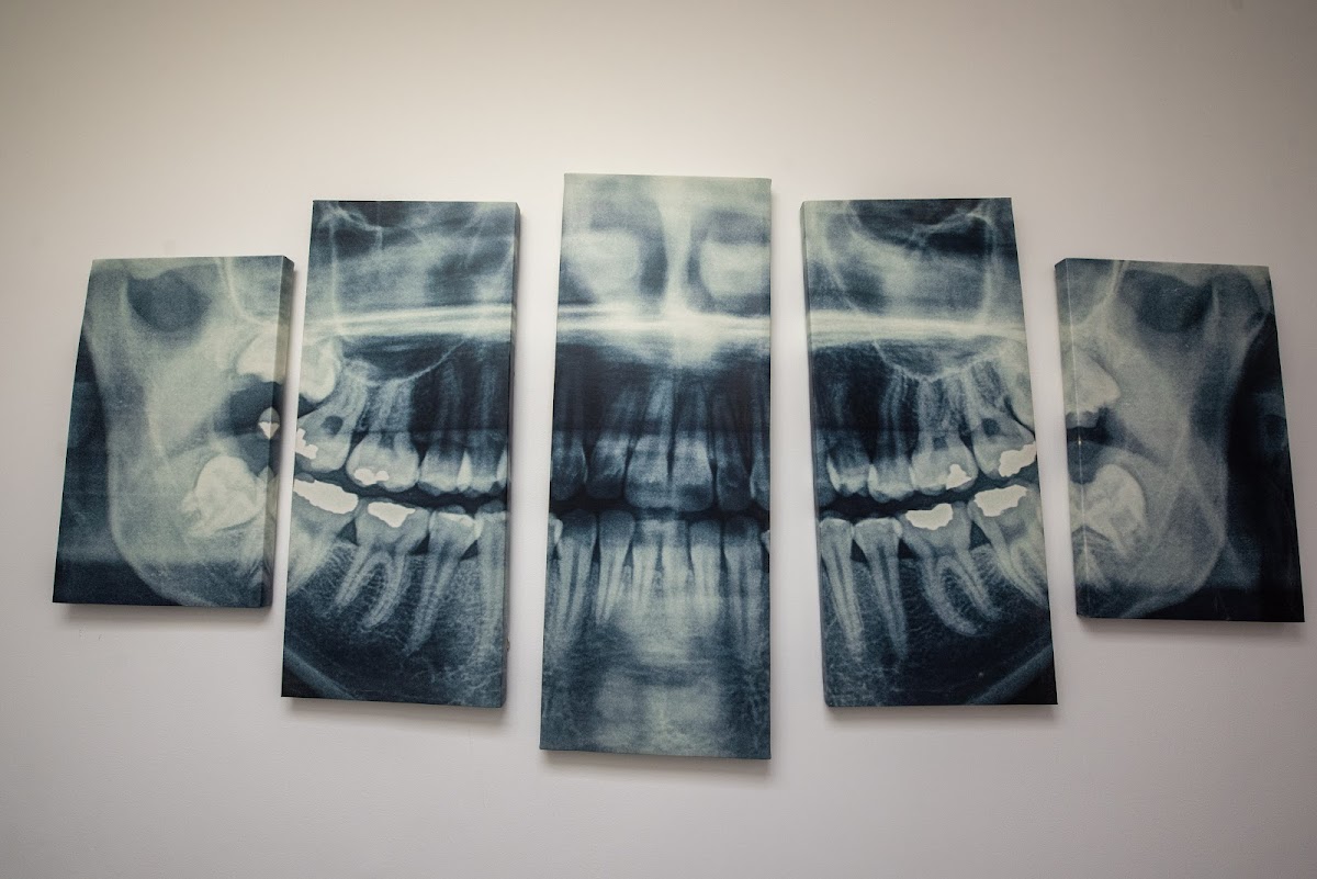 Tijuana Dentist Olive Dental Solution — foto 3