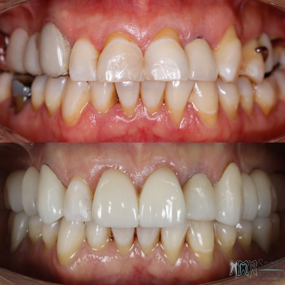 DENTiOSS