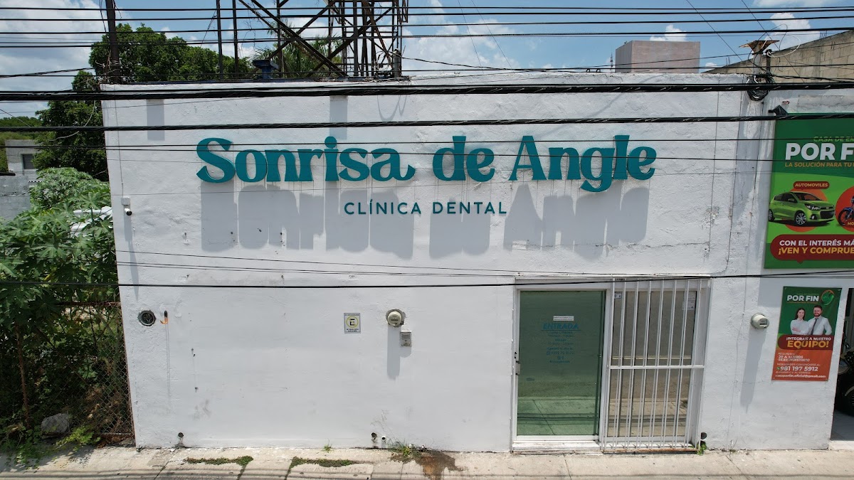 Sonrisa de Angle Circuito Colonias