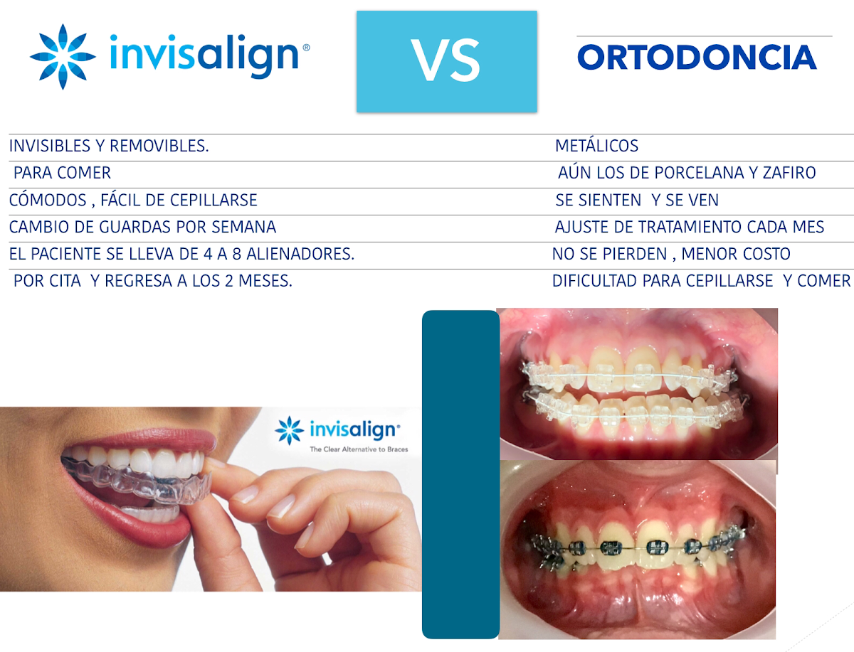 MAXILODENTAL -implantes dentales - Ortodoncia - alineadores — foto 2