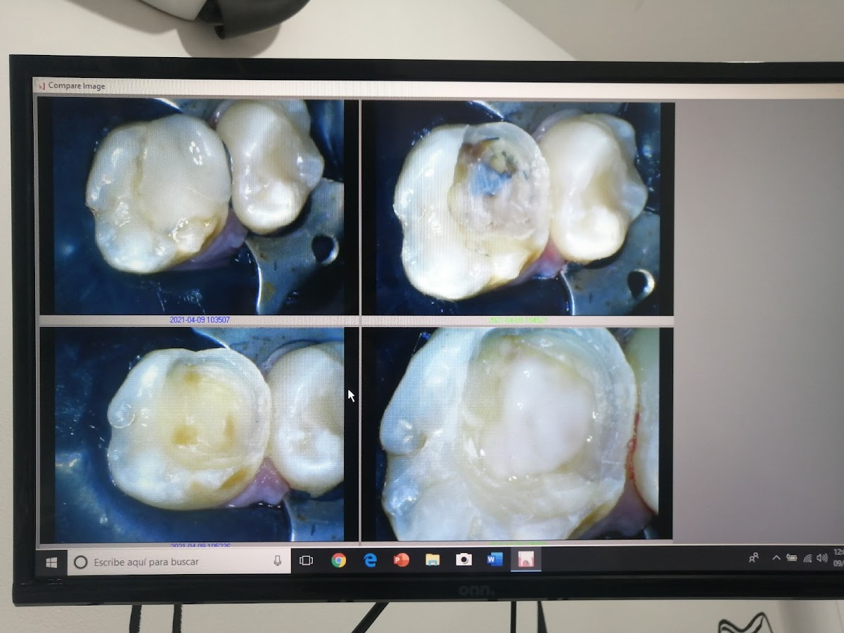 Endotec odontología — foto 2