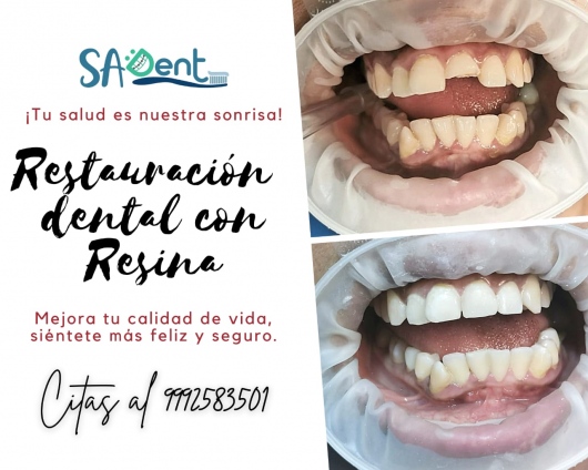 Dra. Sarita N. Escobar Verduzco, Dentista - Odontólogo — foto 4