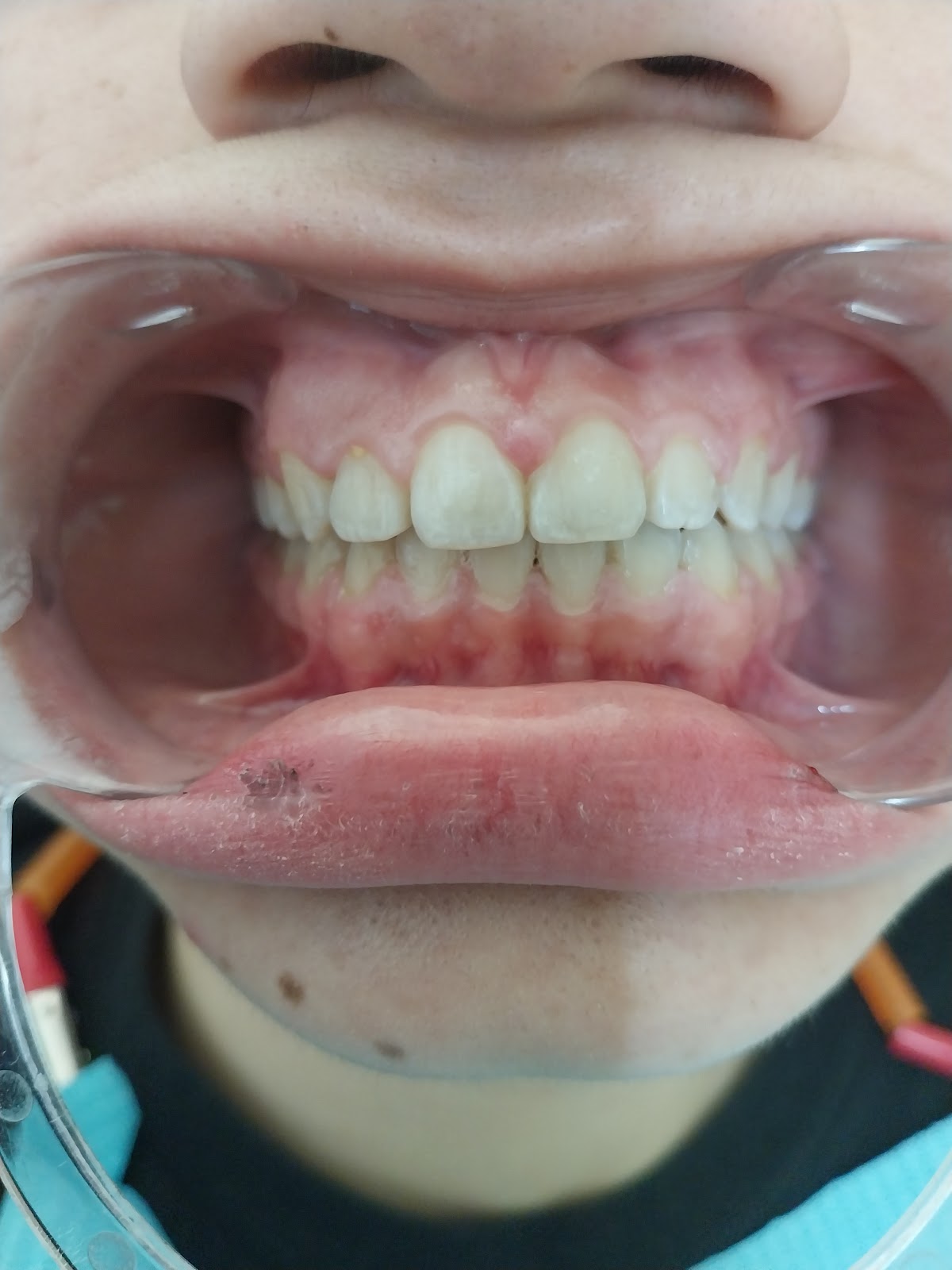 Dra. Sonia Pérez Osuna. Ortodoncista. Brackets. Ortodoncia — foto 4