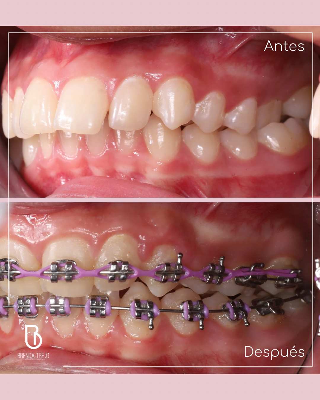 Dentari. Ortodoncia. Dra. Brenda Trejo — foto 2