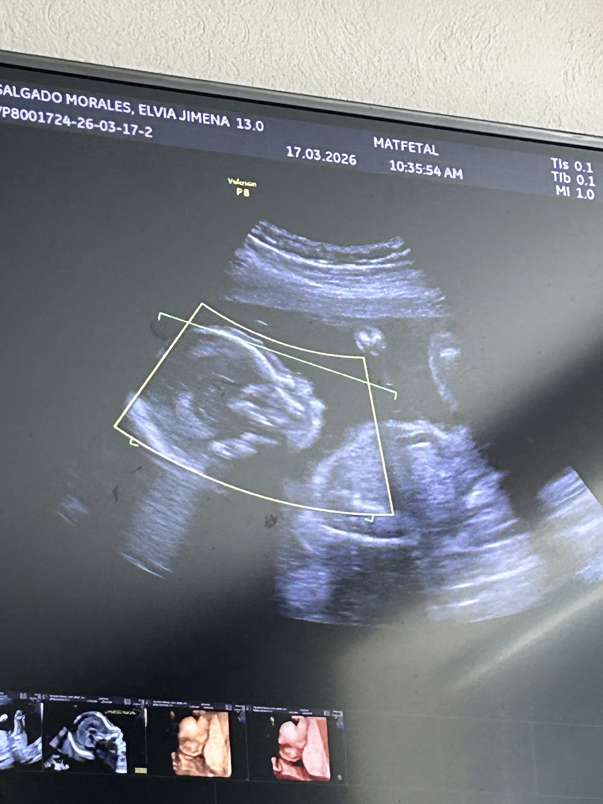 Matfetal Diagnostico Prenatal, Medicina Materno fetal Puebla — foto 3