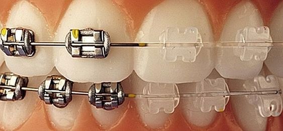 Dentista en Polanco Dr. Alfredo Morales Viramontes