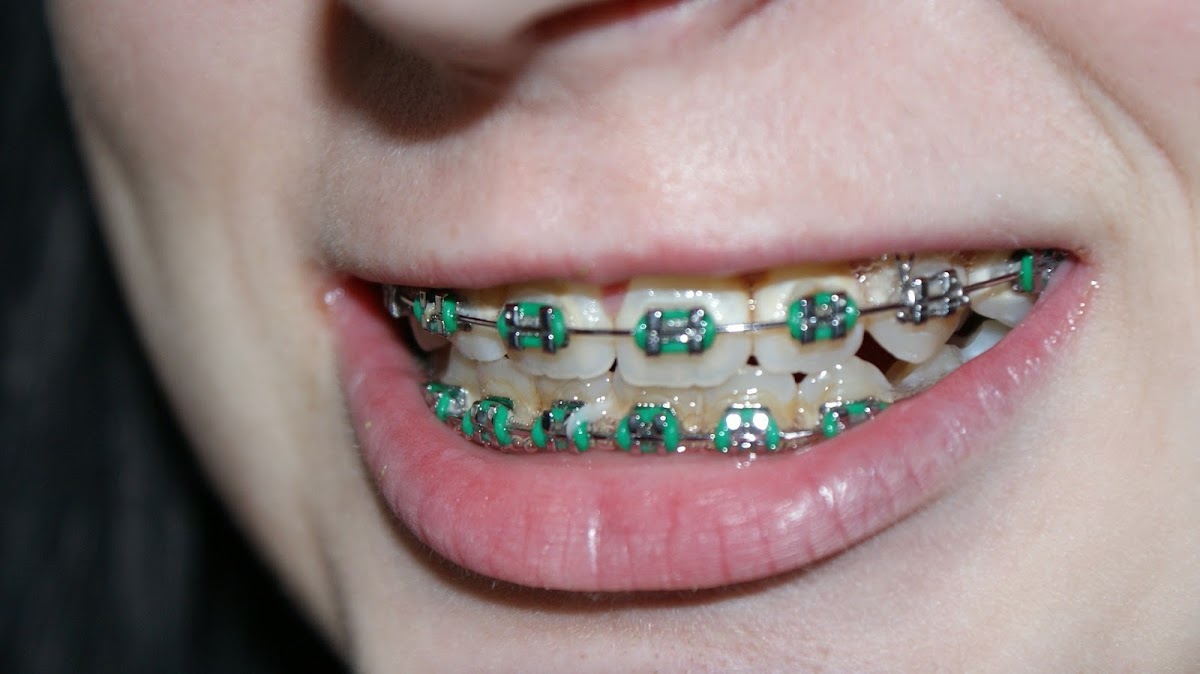 Dentista en Polanco Dr. Alfredo Morales Viramontes — foto 2