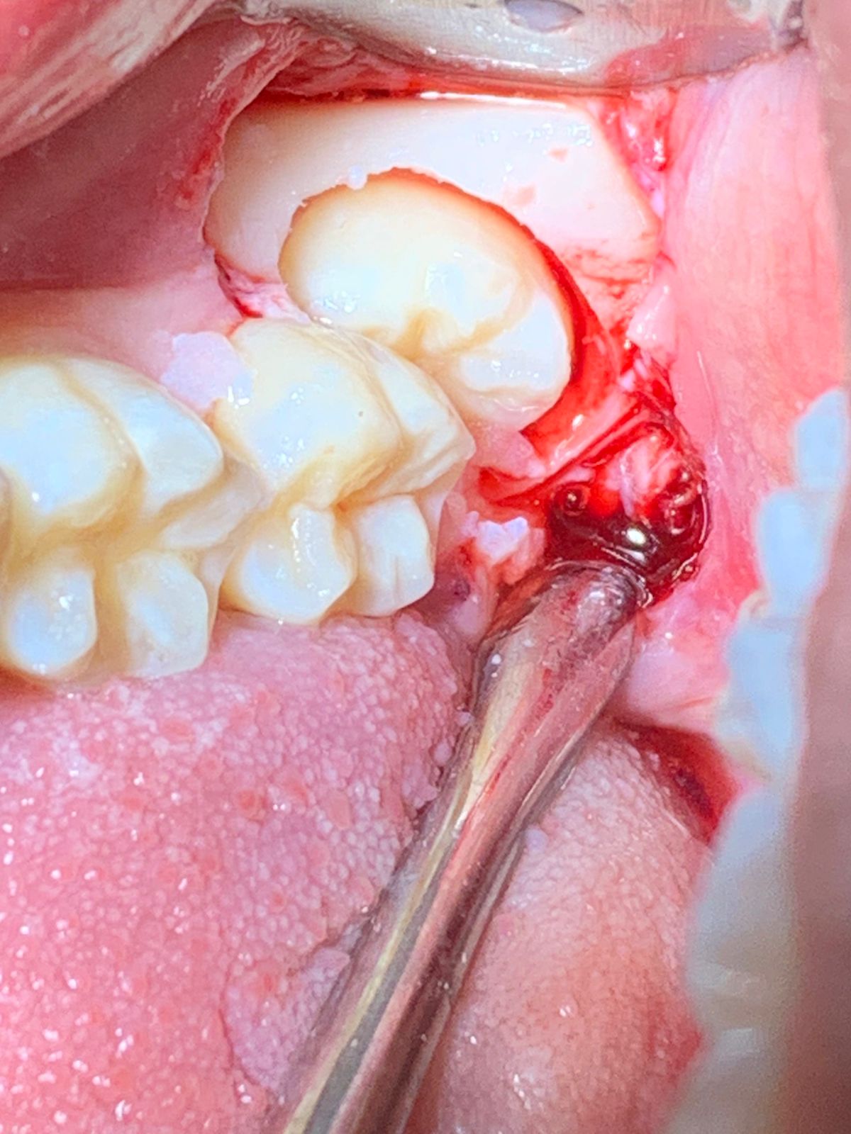 DRA ANA PUENTE SILVA (DENTISTA) — foto 4
