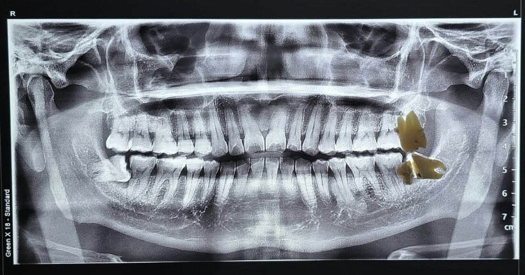 Dental Montejo — foto 2