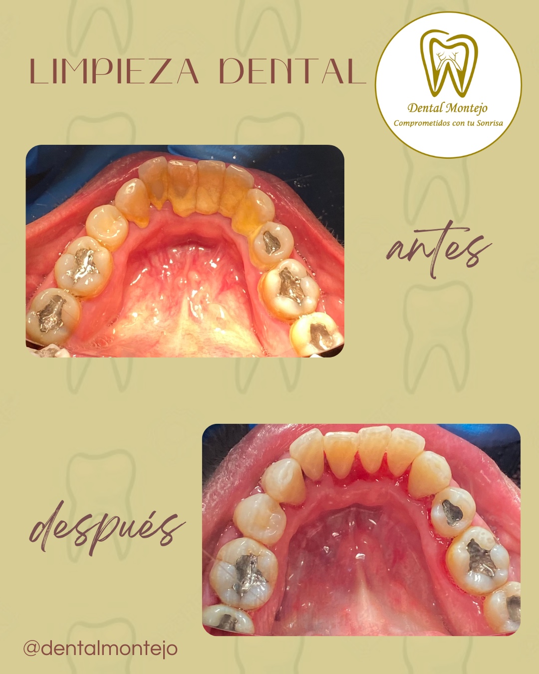 Dental Montejo — foto 4