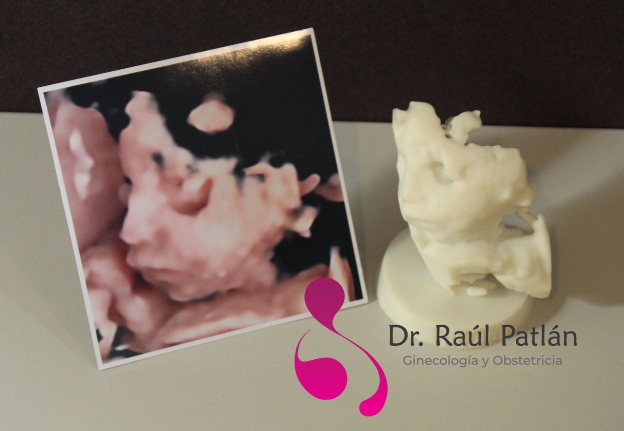 Dr. Raul Alejandro Patlan Montalvo