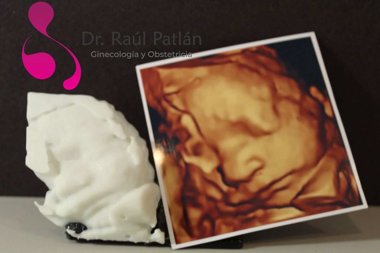 Dr. Raul Alejandro Patlan Montalvo — foto 2